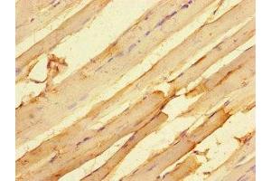 Immunohistochemistry of paraffin-embedded human skeletal muscle tissue using ABIN7172733 at dilution of 1:100 (MTERFD2 抗体  (AA 45-87))
