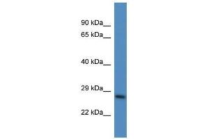 Western Blotting (WB) image for anti-Proteasome (Prosome, Macropain) 26S Subunit, Non-ATPase, 10 (PSMD10) (N-Term) antibody (ABIN928857)
