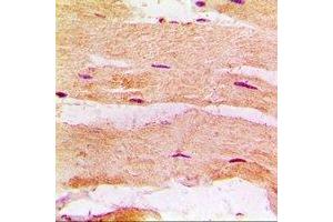 Immunohistochemical analysis of MBNL1 staining in rat heart formalin fixed paraffin embedded tissue section. (MBNL1 抗体)