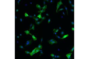 Immunofluorescence detection of human RET expressed in U2OS cells. (Ret Proto-Oncogene 抗体)