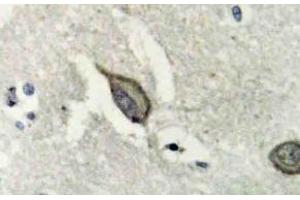 Immunohistochemistry (IHC) analyzes of EphB6 antibody in paraffin-embedded human brain tissue. (EPH Receptor B6 抗体)
