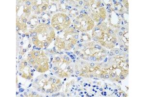 Immunohistochemistry of paraffin-embedded Mouse kidney using HARS2 Polyclonal Antibody at dilution of 1:100 (40x lens). (HARS2 抗体)