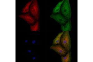 ABIN7094677 and ABIN7098728 staining  cells by IF/ICC. (KCNK9 抗体  (N-Term))