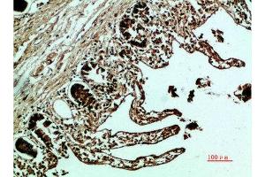 Immunohistochemical analysis of paraffin-embedded human-colon, antibody was diluted at 1:200 (Fibronectin 1 抗体  (AA 1268-1341))