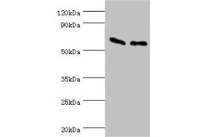 Western Blotting (WB) image for anti-ATP Synthase, H+ Transporting, Mitochondrial F1 Complex, beta Polypeptide (ATP5B) (AA 230-529) antibody (ABIN7144840)