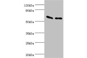 Western blot All lanes: ATP synthase subunit beta, mitochondrial antibody at 9 μg/mL Lane 1: Hela whole cell lysate Lane 2: HepG2 whole cell lysate Secondary Goat polyclonal to rabbit IgG at 1/10000 dilution Predicted band size: 57 kDa Observed band size: 57 kDa (ATP5B 抗体  (AA 230-529))