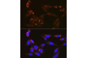 Immunofluorescence analysis of NIH/3T3 cells using PDE4A Rabbit pAb (ABIN7269302) at dilution of 1:100 (40x lens).