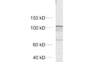 dilution: 1 : 500, sample: crude synaptosomal fraction of rat brain (P2) (ERC2 抗体  (AA 655-670))