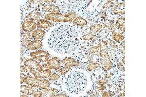 IHC analysis of ATF6 using anti-ATF6 antibody (ABIN7602466).
