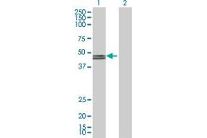 Western Blot analysis of GCDH expression in transfected 293T cell line by GCDH MaxPab polyclonal antibody. (GCDH 抗体  (AA 1-438))