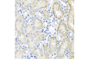 Immunohistochemistry of paraffin-embedded mouse kidney using PSTPIP1 antibody at dilution of 1:100 (x40 lens). (PSTPIP1 抗体)