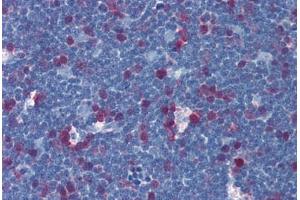 anti-Thymidylate Synthetase (TYMS) (AA 111-211) antibody