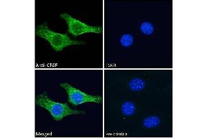 ABIN6391343 Immunofluorescence analysis of paraformaldehyde fixed NIH3T3 cells, permeabilized with 0. (CTGF 抗体  (AA 111-123))