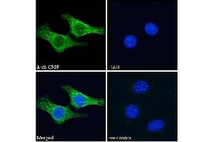 ABIN6391343 Immunofluorescence analysis of paraformaldehyde fixed NIH3T3 cells, permeabilized with 0.