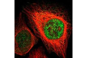 Immunofluorescent staining of U-2 OS with ZIC1 polyclonal antibody  (Green) shows positivity in nucleus but excluded from the nucleoli. (ZIC1 抗体)