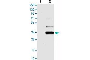 Western blot analysis of Lane 1: Negative control (vector only transfected HEK293T lysate), Lane 2: Over-expression Lysate (Co-expressed with a C-terminal myc-DDK tag (~3. (YAE1D1 抗体)