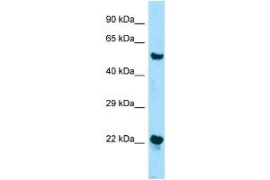 Western Blotting (WB) image for anti-Zinc Finger, DHHC-Type Containing 12 (ZDHHC12) (N-Term) antibody (ABIN2788534) (ZDHHC12 抗体  (N-Term))