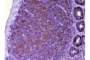 IHC analysis of CTLA4 using anti-CTLA4 antibody . (CTLA4 抗体  (AA 36-161))