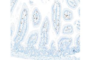 Immunohistochemistry (IHC) image for anti-CD8a Molecule (CD8A) (AA 28-194) antibody (ABIN7453877)