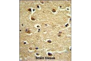 Formalin-fixed and paraffin-embedded human brain tissue reacted with CROT Antibody (N-term), which was peroxidase-conjugated to the secondary antibody, followed by DAB staining. (CROT 抗体  (N-Term))