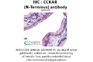 Image no. 1 for anti-Cholecystokinin A Receptor (CCKAR) (Extracellular Domain), (N-Term) antibody (ABIN1732733) (CCKAR 抗体  (Extracellular Domain, N-Term))