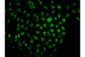 Immunofluorescence staining of Hela cells with ABIN7172910 at 1:166, counter-stained with DAPI.
