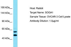 Host: Rabbit Target Name: SOGA1 Sample Type: OVCAR-3 Whole Cell lysates Antibody Dilution: 1.