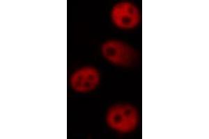 ABIN6266470 staining K562 by IF/ICC. (MAPKAP Kinase 5 抗体  (pThr182))