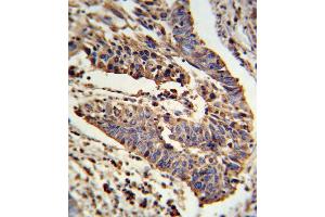 Immunohistochemistry (Paraffin-embedded Sections) (IHC (p)) image for anti-Sodium Channel, Nonvoltage-Gated 1 alpha (SCNN1A) (AA 365-391) antibody (ABIN652752)