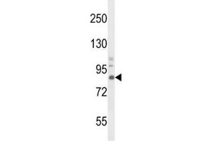 Western Blotting (WB) image for anti-Neurotrophic Tyrosine Kinase, Receptor, Type 1 (NTRK1) antibody (ABIN3031990)