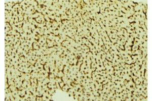 ABIN6273820 at 1/100 staining Mouse liver tissue by IHC-P. (VRK2 抗体  (Internal Region))