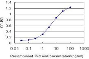 Detection limit for recombinant GST tagged RORB is approximately 0. (RORB 抗体  (AA 136-224))