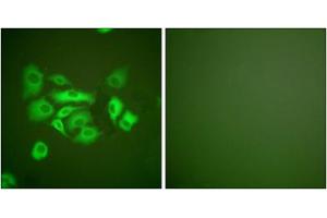 Immunofluorescence (IF) image for anti-Keratin 10 (KRT10) (Internal Region) antibody (ABIN1848644) (Keratin 10 抗体  (Internal Region))