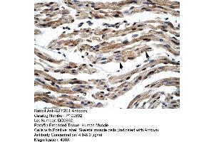 Immunohistochemistry (IHC) image for anti-General Transcription Factor IIE, Polypeptide 1, alpha 56kDa (GTF2E1) (C-Term) antibody (ABIN2792638)