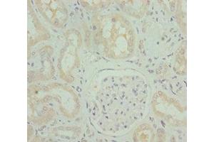 Immunohistochemistry (IHC) image for anti-Optic Atrophy 3 (Autosomal Recessive, with Chorea and Spastic Paraplegia) (OPA3) (AA 25-179) antibody (ABIN7162248)