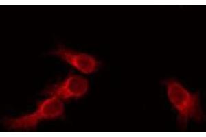 ABIN6275718 staining HeLa by IF/ICC. (RNF130 抗体  (Internal Region))