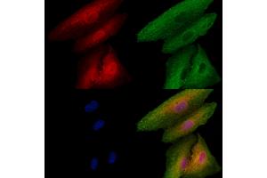 ABIN6256863 and ABIN6273491 staining  cells by IF/ICC.