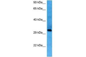Host:  Mouse  Target Name:  SIX1  Sample Tissue:  Mouse Spleen  Antibody Dilution:  1ug/ml (SIX Homeobox 1 抗体  (Middle Region))