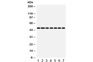 Western blot testing of 1) rat heart, 2) rat liver, 3) mouse NIH3T3, 4) human SW620, 5) HeLa, 6) MCF7 and 7) 22RV1 lysate with IDH2 antibody.
