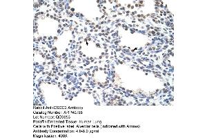 Rabbit Anti-CSDC2 Antibody  Paraffin Embedded Tissue: Human Lung Cellular Data: Alveolar cells Antibody Concentration: 4. (CSDC2 抗体  (N-Term))