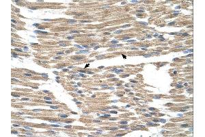 GPR177 antibody was used for immunohistochemistry at a concentration of 4-8 ug/ml. (GPR177/WLS 抗体  (N-Term))