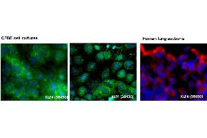 Immunohistochemistry (IHC) image for anti-Kruppel-Like Factor 4 (Gut) (KLF4) (C-Term) antibody (ABIN2780577)