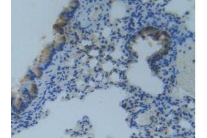 IHC-P analysis of Mouse Lung Tissue, with DAB staining. (MMP14 抗体  (AA 121-487))
