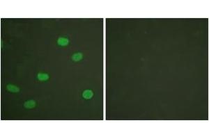 Immunofluorescence analysis of HeLa cells, using Lamin A/C (Phospho-Ser392) Antibody. (Lamin A/C 抗体  (pSer392))