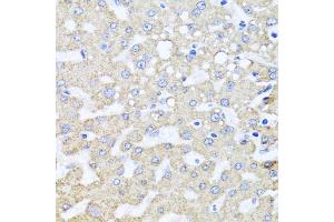 Immunohistochemistry of paraffin-embedded human liver injury using ARL6 antibody (ABIN5974886) at dilution of 1/100 (40x lens). (ARL6 抗体)