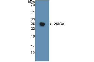 Western blot analysis of recombinant Human GSTm1. (GSTM1 抗体  (AA 1-218))