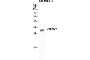 Western Blot (WB) analysis of Rat Muscle cells using C/EBP delta/epsilon Polyclonal Antibody. (C/EBP delta/epsilon (C-Term) 抗体)