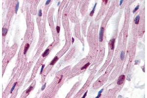 Immunohistochemistry staining of human heart (paraffin sections) using anti-alpha tubulin (TU-16). (alpha Tubulin 抗体)