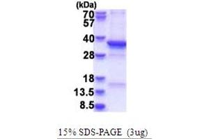 SDS-PAGE (SDS) image for Ts Translation Elongation Factor, Mitochondrial (TSFM) (AA 46-346) protein (ABIN5853717) (TSFM Protein (AA 46-346))