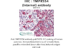 Image no. 1 for anti-Transmembrane Protease, serine 4 (TMPRSS4) (Internal Region) antibody (ABIN1740175) (TMPRSS4 抗体  (Internal Region))